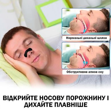 Полоски для улучшения дыхания Носовой патч против храпа 30 шт