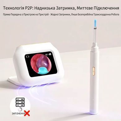 Цифровий отоскоп Камера для чищення вух з екраном 2.8" та LED-підсвічуванням